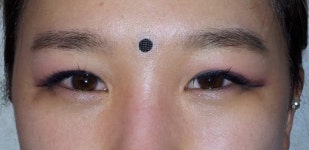 추운겨울 다발하는 비염 원인은 어디에서 오는 것일까?