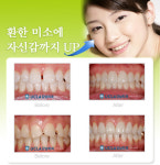 치아미백 시술로 환한 미소에 자신감까지 UP~!