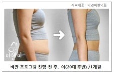 한방다이어트로 당당한 월드컵 응원하자