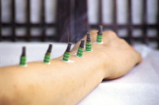 국민 10명 중 7명, ‘민간요법 경험했다’