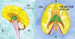 시상, 지긋지긋한 통증에서 벗어나기