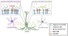 알츠하이머 치매 발병 과정 규명으로 치료의 새로운 방향성 제시