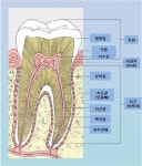 치과에서 마취 꼭 해야할까?