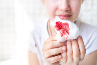 조기 진단·치료 중요한 희귀질환인데…진단방랑 평균 13년 '고셔병'