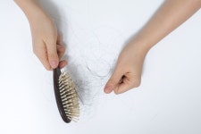 머리 빗을 때 우수수 떨어지는 머리카락?…진행 빠른 원형탈모 대처법
