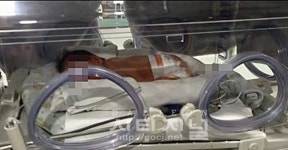 대전 한 산후조리원, 신생아 집단 호흡기질환 감염