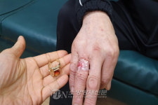 부평소방서, ‘왼손 한 번, 오른손 한 번’ 반지 제거 척척