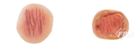 [INdustrial Technology] (주)메스코리아, 전문적 응급처치 실습 위한 인조 상처 키트