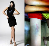 ´폭행논란´ 이상구vs김미리내, 엇갈린 주장..CCTV가 답!