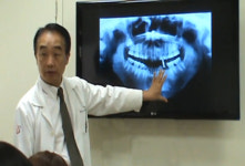 앞니 임플란트, 병원 선택에 더 신중해야 한다