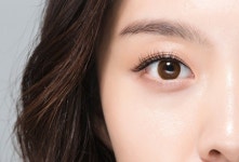 뒤늦은 눈썹문신 제거, 눈과 가까운 부위여서 안정성 확인해야