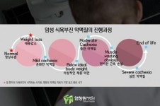 암 환자의 암성 식욕부진 ‘악액질’, 간과하지 말고 치료해야