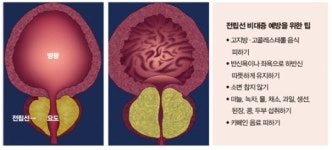 롤링제이(RollingJ)미래병원점 | 미래 치료는 레이저 수술이 대세
