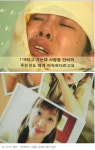 끔찍한 황산테러 피해자 정아씨, 한달 후 동영상 공개에 눈물바다