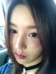 남규리, 얼굴 멍자국+찢겨진 입술 어쩌다가 이런 일이