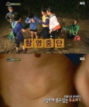 김병만 촬영 중단, 콩가개미에게 물려 붓고 가려움증... 병만족장 쓰러트린 개미? 경악