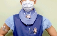 내시경·PELD, 방사선노출 최소화해 시술할 수 있는 건수?