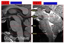 국산 MRI, 글로벌 업체와 경쟁 충분하다