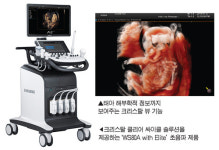 임신 준비∼태아건강까지 초음파 진단 가능