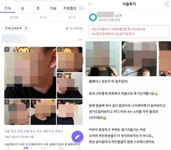 '성형 앱' 주의보…