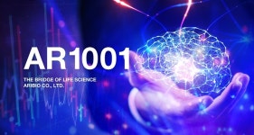 아리바이오 후보물질 알츠하이머 완화아닌 치료 기대