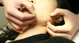 칼 대신 침 한방으로 ‘꽃중년’ 주름잡는다