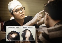 급증하는 원형탈모… 모리의원, “스테로이드 쓰지 않는 근본치료가 중요”