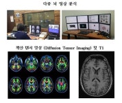 국내 연구팀, 외상후 스트레스 장애 회복과정 실마리 찾아