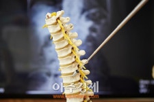 척추질환, 병명보다 병소 위치가 중요