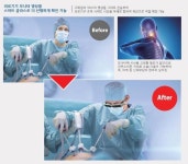 메디싱크, 세계 최초 의료용 무선 스마트 글라스 출시  