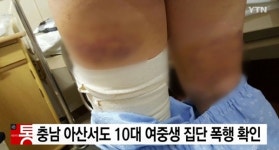 아산 여중생 모텔 감금 폭행사건…허술한 법망 이용하는 10대 흉악범죄