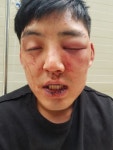 양호석, 차오름 폭행…공개한 사진 보니? 술자리서 쇼하지 말라며 얼굴 발로 차