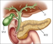 담도암, 대표적 증상 및 치료법은?... 생존률 30% 조기 발견이 중요