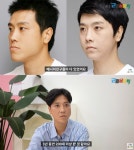개콘 개그맨 이동윤 양악수술 후 사경 헤매. 중고차 딜러 일하며 100억 매출