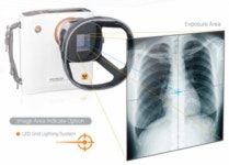 레메디, 의료용 포터블 X선 촬영장치 정부혁신제품 선정