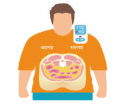 [비만을 체포하자] 지금은 3명중 1명이지만… 10년뒤엔 1등국 오명