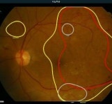 GC녹십자아이메드, ‘뷰노메드 펀더스 AI’ 도입