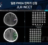 제이엘케이, 뇌졸중 AI 솔루션 ‘JLK-NCCT’ 일본 PMDA 신청