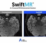 에어스메디컬,MRI AI솔루션 ‘스위프트엠알’ 서울대병원 공급