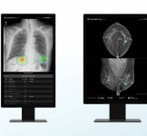 루닛,AI 암 진단 솔루션  GC녹십자아이메드 공급..건강검진 사업 확장