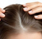 미생물군집 중심 두피케어..헤어케어 새 트렌드!