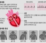 [생활요법] 심방세동의 생활요법