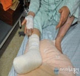 [장애인신문]라꾸라꾸 침대, 사용중 화재 화상