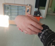 대구 의수족 전문기업 신세계의수족연구소 무통증 의족 제작