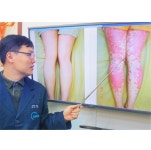 건선, 소아 청소년은 가족력 확률 높아 주의해야