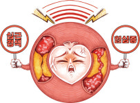 심장이 보낸 신호, ‘S’top ‘O’r ‘S’low
