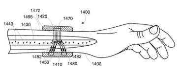‘닥터 구글’, 암 치료 의료기기 특허출원