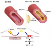 방사선 부작용 해소될까? 새 치료 가능성 제시