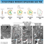 노인 주된 실명 초래 황반변성 ’발병 기전 규명