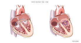 서울아산병원 